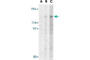 Western blot analysis of TBC1D1 in Daudi cell lysate with TBC1D1 polyclonal antibody  at (A) 1, (B) 2 and (C) 4 ug/mL . (TBC1D1 antibody  (C-Term))