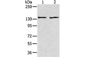 Gel: 6 % SDS-PAGE, Lysate: 40 μg, Lane 1-2: A431 and 293T cell, Primary antibody: ABIN7189660(ADAMTS2 Antibody) at dilution 1/200 dilution, Secondary antibody: Goat anti rabbit IgG at 1/8000 dilution, Exposure time: 1 minute (Adamts2 antibody)