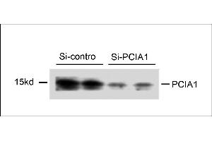 Western blot analysis of extracts from 293T cells that were transfected with si-control or transfected si-PCIA1, using rabbit polyclonal PCIA1 Antibody (Center) (ABIN658015 and ABIN2846953). (DDA1 antibody  (AA 11-40))