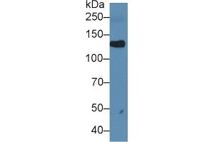 Western blot analysis of Rat Serum, using Rat LIFR Antibody (1 µg/ml) and HRP-conjugated Goat Anti-Rabbit antibody (