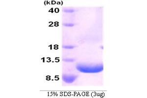 SDS-PAGE (SDS) image for Chemokine (C-X-C Motif) Ligand 2 (CXCL2) (AA 35-107) protein (His tag) (ABIN666759)