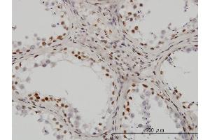 Immunoperoxidase of monoclonal antibody to UBTF on formalin-fixed paraffin-embedded human testis.