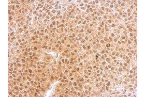 IHC-P Image RNF25 antibody [C2C3], C-term detects RNF25 protein at nucleus and cytosol on HeLa xenograft by immunohistochemical analysis. (RNF25 antibody  (C-Term))