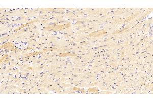 Detection of ROR1 in Mouse Heart Tissue using Polyclonal Antibody to Receptor Tyrosine Kinase Like Orphan Receptor 1 (ROR1) (ROR1 antibody  (AA 470-707))