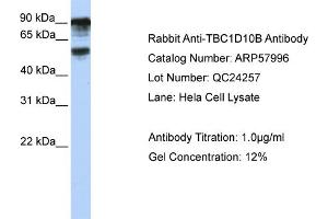WB Suggested Anti-TBC1D10B  Antibody Titration: 0. (TBC1D10B antibody  (C-Term))