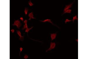 Immunofluorescence (fixed cells) (IF/ICC) image for anti-Leukocyte Immunoglobulin-Like Receptor, Subfamily A (With TM Domain), Member 2 (LILRA2) (C-Term) antibody (ABIN6258958)