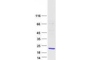 Validation with Western Blot (WTAP Protein (Transcript Variant 3) (Myc-DYKDDDDK Tag))