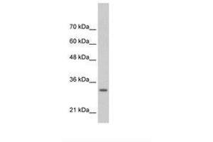 Image no. 2 for anti-Transcription Factor MafB (MAFB) (AA 41-90) antibody (ABIN6736309) (MAFB antibody  (AA 41-90))