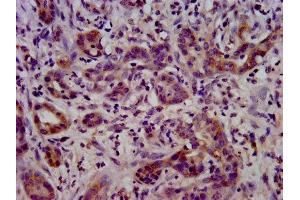 LSR antibody  (AA 112-233)