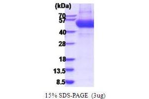 SDS-PAGE (SDS) image for Interleukin 13 Receptor, alpha 1 (IL13RA1) (AA 22-343) protein (His tag) (ABIN5854209)