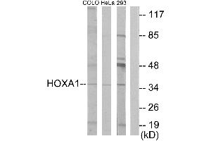 Western blot analysis of extracts from COLO cells, HeLa/ cells and 293 cells, using HOXA1 antibody.