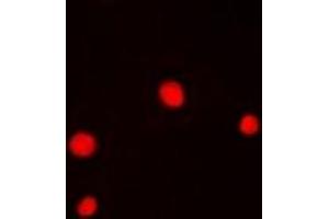 Immunofluorescent analysis of GABPB1 staining in Hela cells. (GABPB1 antibody)