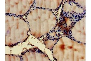 Immunohistochemistry of paraffin-embedded human thyroid tissue using ABIN7144546 at dilution of 1:100 (GIT1 antibody  (AA 470-642))