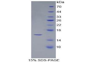 SDS-PAGE (SDS) image for Secreted Frizzled-Related Protein 5 (SFRP5) (AA 48-165) protein (His tag) (ABIN1879961)