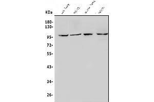 Western blot analysis of HIF-2-Alpha/EPAS1 using anti-HIF-2-Alpha/EPAS1 antibody (ABIN7602827).