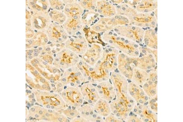 SLC6A19 antibody