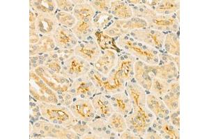 Immunohistochemistry of paraffin embedded rat kidney using SLC6A19 (ABIN7075682) at dilution of 1:900 (400x lens)