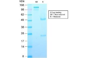 SDS-PAGE Analysis Purified Growth Hormone Recombinant Mouse Monoclonal (rGH/1450). (Recombinant Growth Hormone 1 antibody  (AA 58-187))