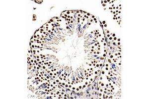 Immunohistochemistry of paraffin embedded mouse testis using Api5 (ABIN7073094) at dilution of 1:350 (400x lens) (Apoptosis Inhibitor 5 antibody)