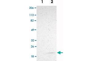 Western Blot analysis of Lane 1: RT-4 and Lane 2: U-251MG sp cell lysates with GSTP1 polyclonal antibody . (GSTP1 antibody)