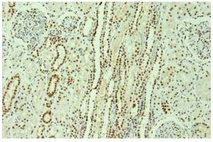 Image no. 3 for anti-Heterogeneous Nuclear Ribonucleoprotein L (HNRNPL) antibody (ABIN108560) (HNRNPL antibody)