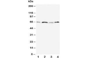 Western blot testing of OPN antibody and Lane 1:  MM231;  2: HeLa;  3: Jurkat;  4: COLO320 cell lysate. (Osteopontin antibody  (N-Term))