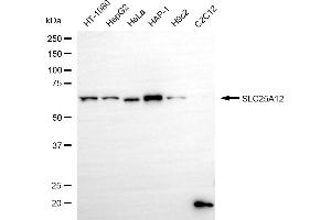 anti-Solute Carrier Family 25 (Mitochondrial Carrier, Aralar), Member 12 (Slc25a12) antibody