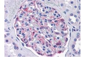 Immunohistochemistry (IHC) image for anti-Solute Carrier Family 44, Member 2 (SLC44A2) (AA 123-231) antibody (ABIN614725) (SLC44A2 antibody  (AA 123-231))