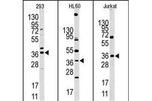 Western blot analysis of anti-HIF1AN (N-term) Pab in 293, HL60 and Jurkat cell line lysates. (HIF1AN antibody  (N-Term))
