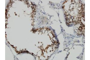 Immunoperoxidase of monoclonal antibody to POMZP3 on formalin-fixed paraffin-embedded human testis. (POMZP3 antibody  (AA 64-116))