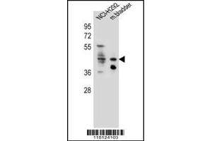Western blot analysis in NCI-H292 cell line and mouse bladder tissue lysates (35ug/lane). (Goldenhar Syndrome antibody  (C-Term))