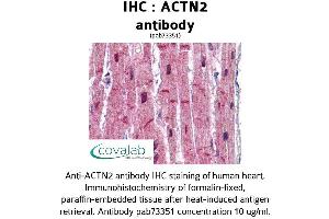 Image no. 1 for anti-Actinin, alpha 2 (ACTN2) (AA 215-500) antibody (ABIN1731491) (ACTN2 antibody  (AA 215-500))
