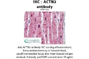 Image no. 1 for anti-Actinin, alpha 2 (ACTN2) (AA 215-500) antibody (ABIN1731491) (ACTN2 antibody  (AA 215-500))