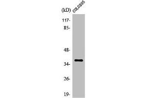 OR52B2 antibody  (Internal Region)