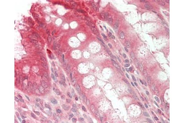 BLOC1S1 antibody  (Biotin)