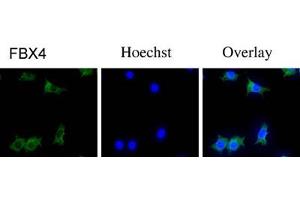 Immunofluorescence staining of NIH/3T3 cells with FBX4 polyclonal antibody  . (FBXO4 antibody  (N-Term))