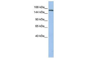 UBE3A antibody used at 1 ug/ml to detect target protein. (ube3a antibody  (N-Term))