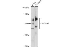 Western blot analysis of extracts of various cell lines, using SLC38 antibody (ABIN7270455) at 1:1000 dilution. (SLC38A1 antibody  (AA 1-70))