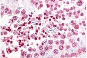 Anti-INADL antibody IHC staining of human testis. (PATJ antibody  (AA 2-14))