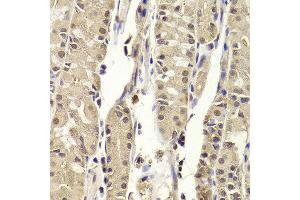 Immunohistochemistry of paraffin-embedded Human gastric using BLZF1 antibody at dilution of 1:100 (x400 lens). (BLZF1 antibody)