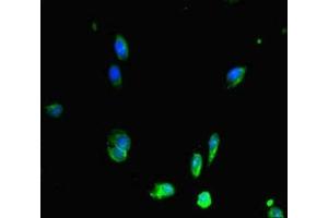 Immunofluorescent analysis of Hela cells using ABIN7150287 at dilution of 1:100 and Alexa Fluor 488-congugated AffiniPure Goat Anti-Rabbit IgG(H+L) (RAD51 antibody  (AA 1-228))