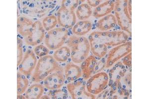 Immunohistochemistry (IHC) image for anti-Purine Nucleoside Phosphorylase (PNP) (AA 1-289) antibody (ABIN5014042)