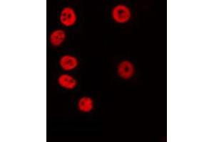 ABIN6274707 staining COLO205 by IF/ICC. (KLF7 antibody  (Internal Region))