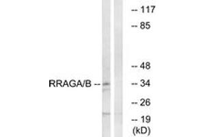 Western blot analysis of extracts from HepG2 cells, using RRAGA/B Antibody. (RRAGA/B antibody  (AA 264-313))