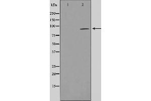 Western blot analysis on LOVO cell lysate using AKAP2 Antibody,The lane on the left is treated with the antigen-specific peptide. (AKAP2 antibody  (N-Term))