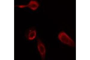ABIN6275785 staining Hela cells by IF/ICC. (Phospholipase C beta 2 antibody  (Internal Region))