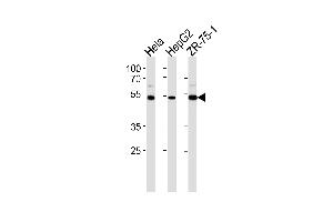 TERF2IP Antibody (C-term) (ABIN657968 and ABIN2846914) western blot analysis in Hela,HepG2,ZR-75-1 cell line lysates (35 μg/lane).