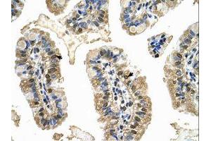 Image no. 1 for anti-Minichromosome Maintenance Deficient 8 (MCM8) (AA 717-766) antibody (ABIN6737804) (MCM8 antibody  (AA 717-766))