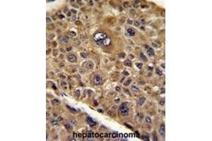 Immunohistochemistry (IHC) image for anti-Protein Tob1 (TOB1) antibody (ABIN3003808) (Protein Tob1 (TOB1) antibody)