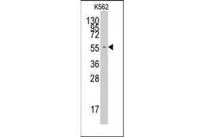 Western blot analysis of anti-FARSA Pab in K562 cell line lysates (35ug/lane). (Phenylalanyl-tRNA Synthetase, alpha Subunit (FARSA) (N-Term) antibody)